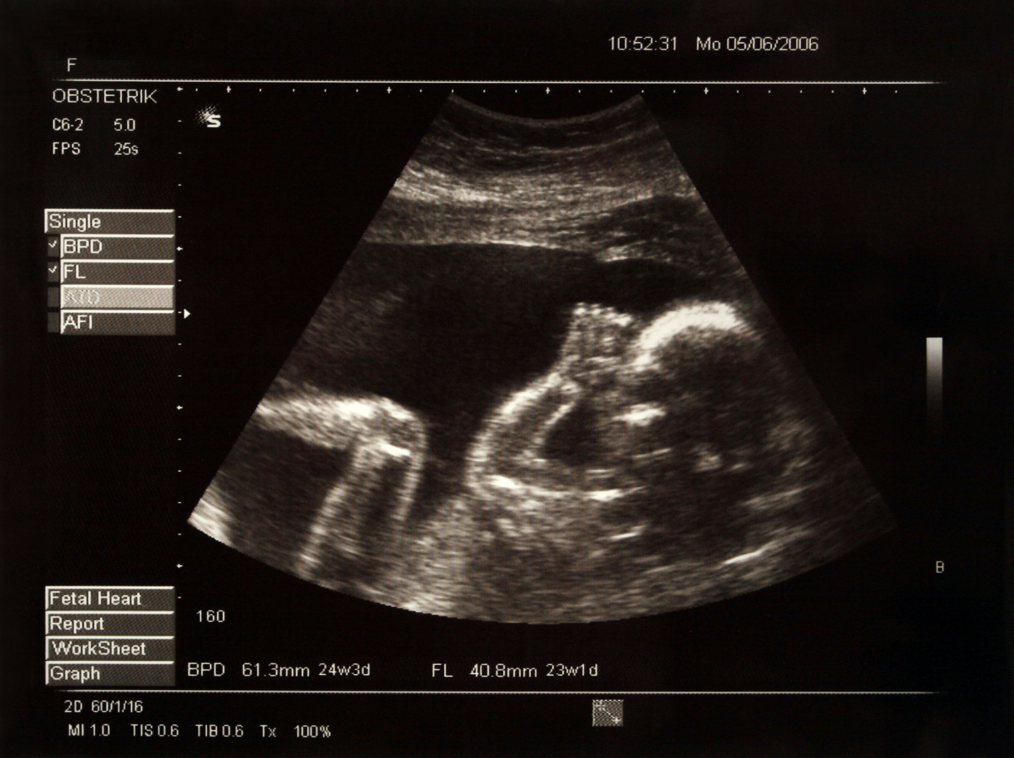 Nevada and Idaho jump out in report on rates of prenatal care for pregnant minors - Vimarsana News