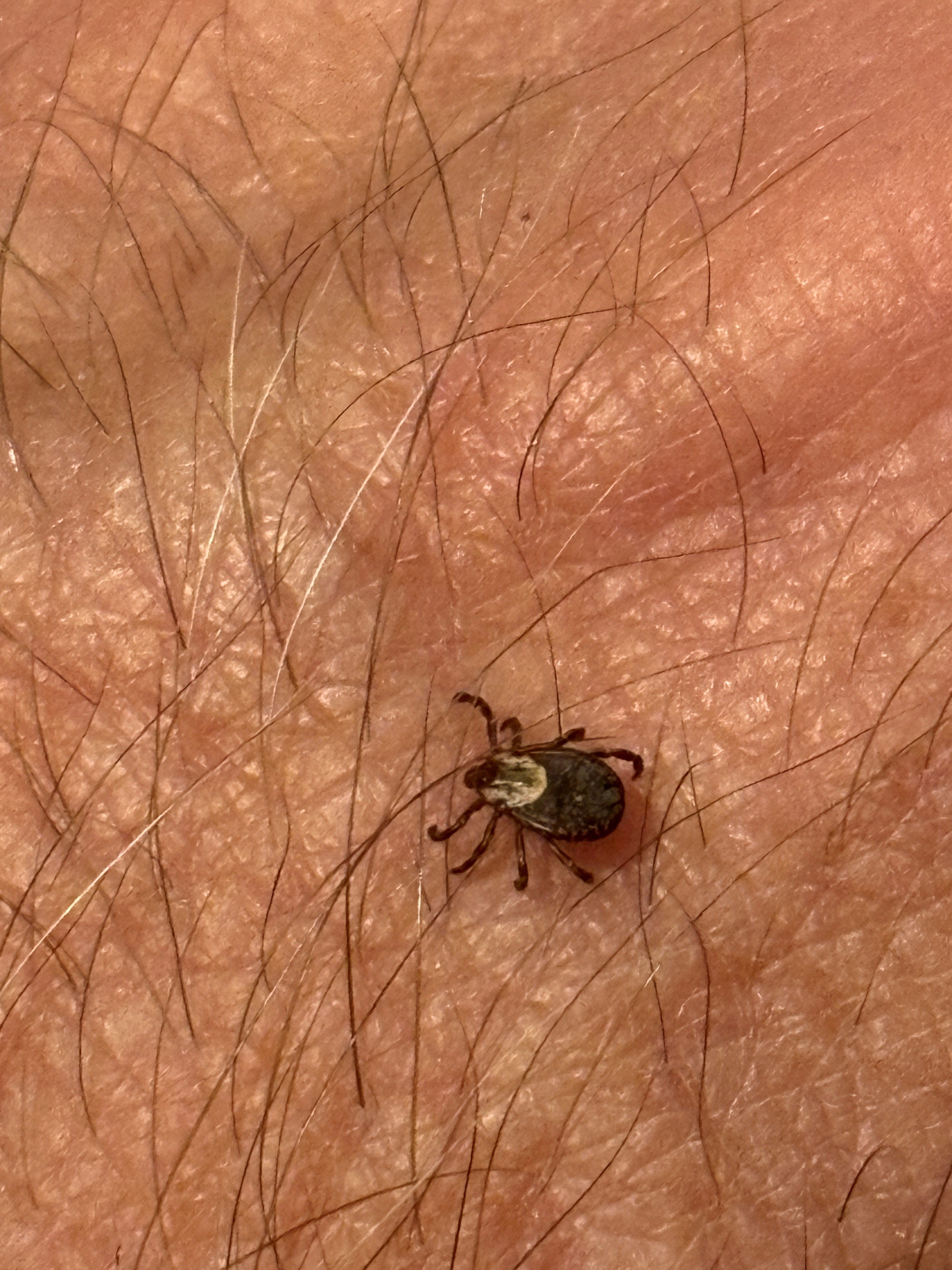 Ticks are active; how to protect yourself and your pets, image size:3024x4032