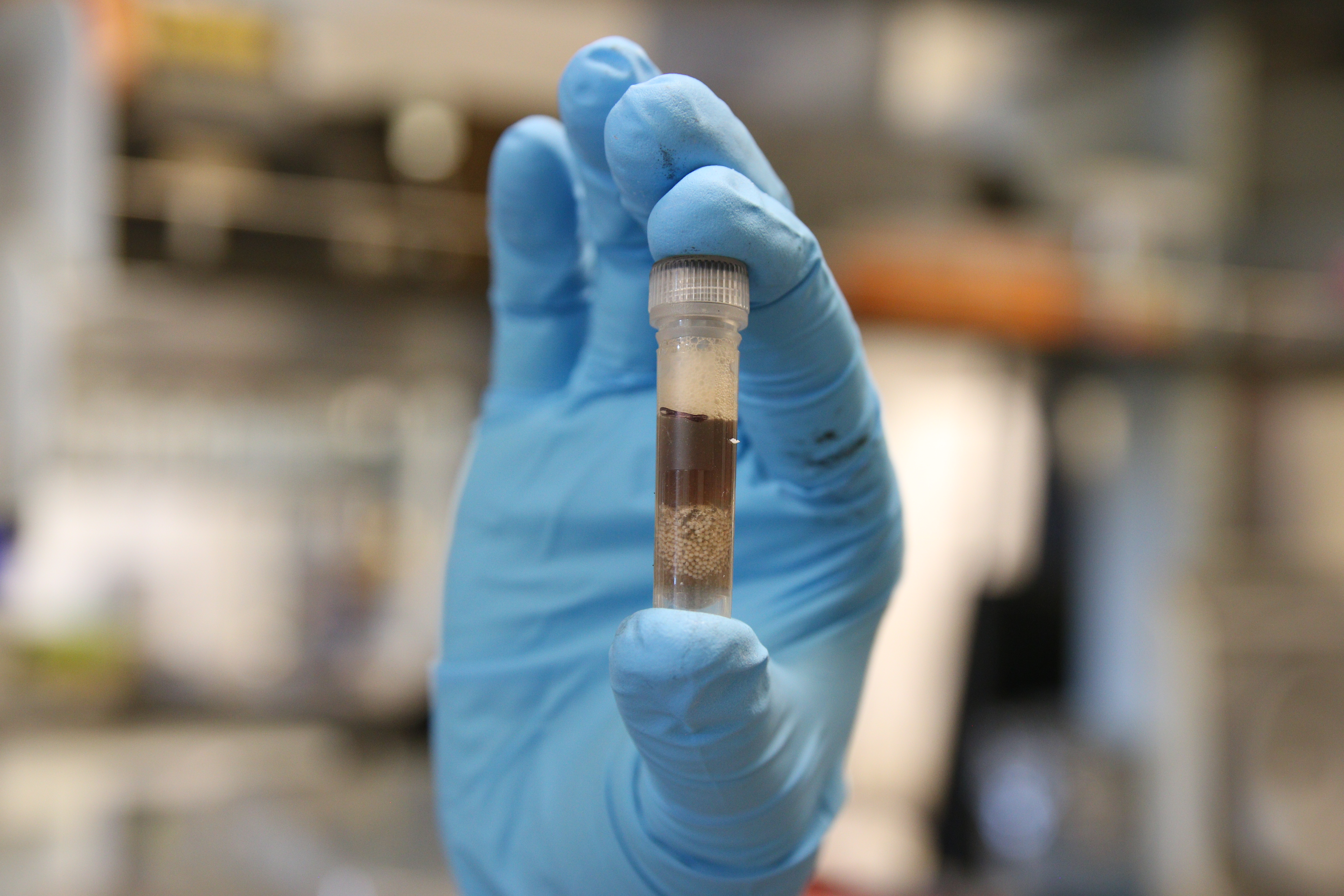 Colorado researchers examine how soil rebuilds itself after wildfires - Vimarsana News
