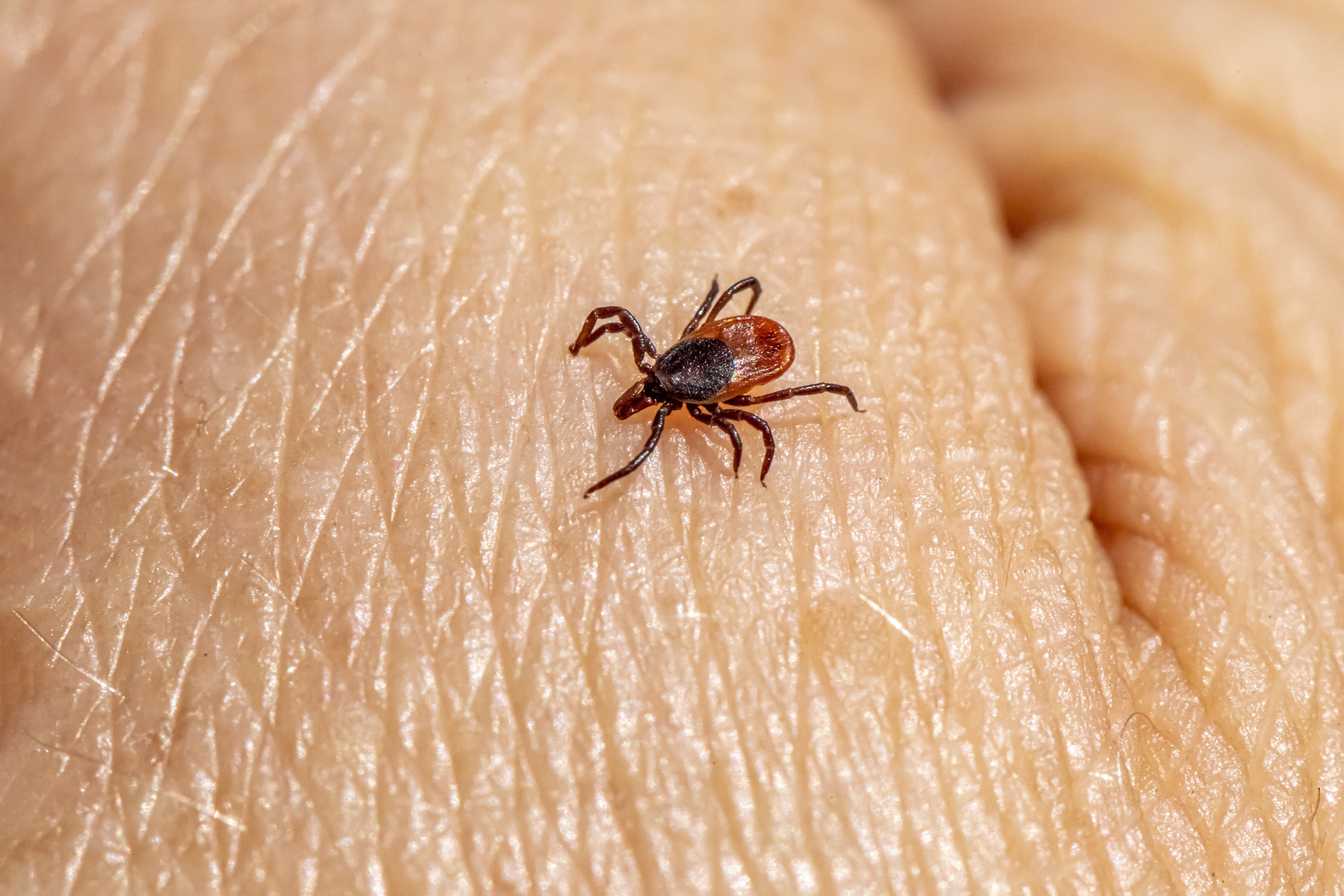 Ticks pose a growing threat to Texans, pets and livestock | TPR