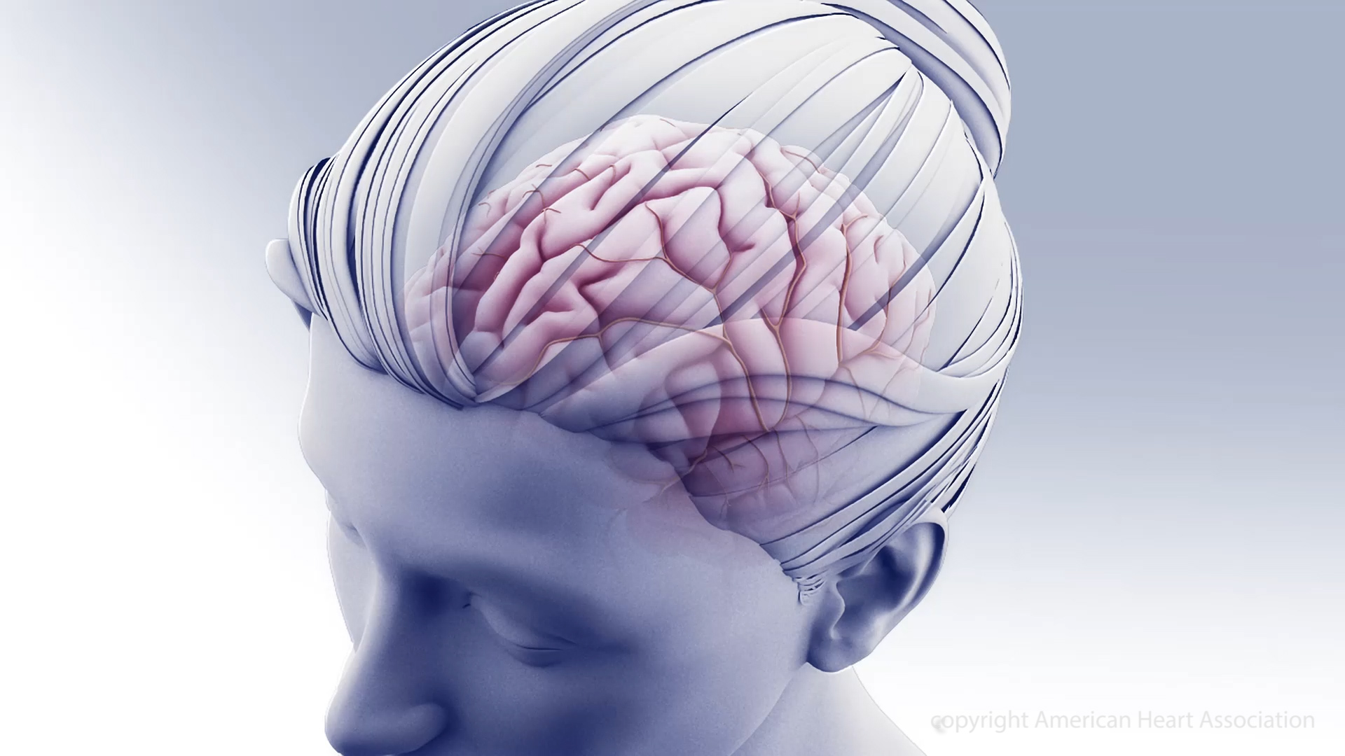 Most Americans are within an hour of stroke care, but access is worst in the Mountain West - Vimarsana News