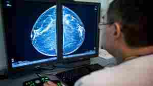 When radiologists review mammograms for signs of breast cancer, they can also see arterial calcification in the breast, which is linked with cardiovascular disease risk.