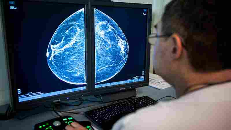When radiologists review mammograms for signs of breast cancer, they can also see arterial calcification in the breast, which is linked with cardiovascular disease risk.