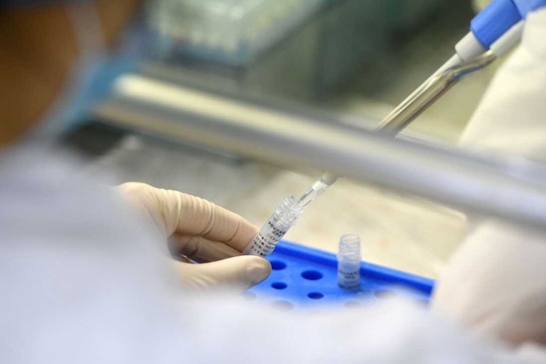 WUHAN, CHINA - AUGUST 05 2021: An operator works in the Huo-Yan (Fire Eye) Laboratory designed for high-capacity 2019-nCoV (SARS-CoV-2) detection in Wuhan in central China's Hubei province Thursday, Aug. 05, 2021. (Photo credit should read Feature China/F