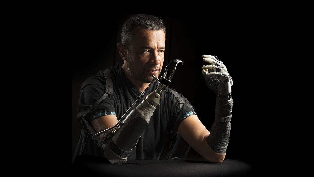 Samoana Matagi was one of the four participants in a study that tested the capabilities of a new bionic hand. Here, Matagi wears the bionic hand on one arm and a common prosthetic called a body-powered hook on the other.