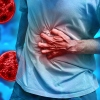 Cyclosporiasis is a parasitic illness caused by eating or drinking contaminated food or water.