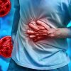 Cyclosporiasis is a parasitic illness caused by eating or drinking contaminated food or water.
