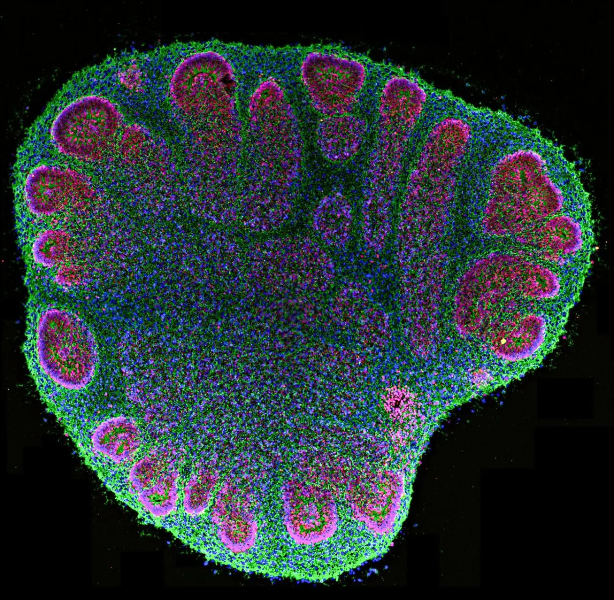 Brain Organoids Python Brain organoids are helping researchers, but their use also creates ...