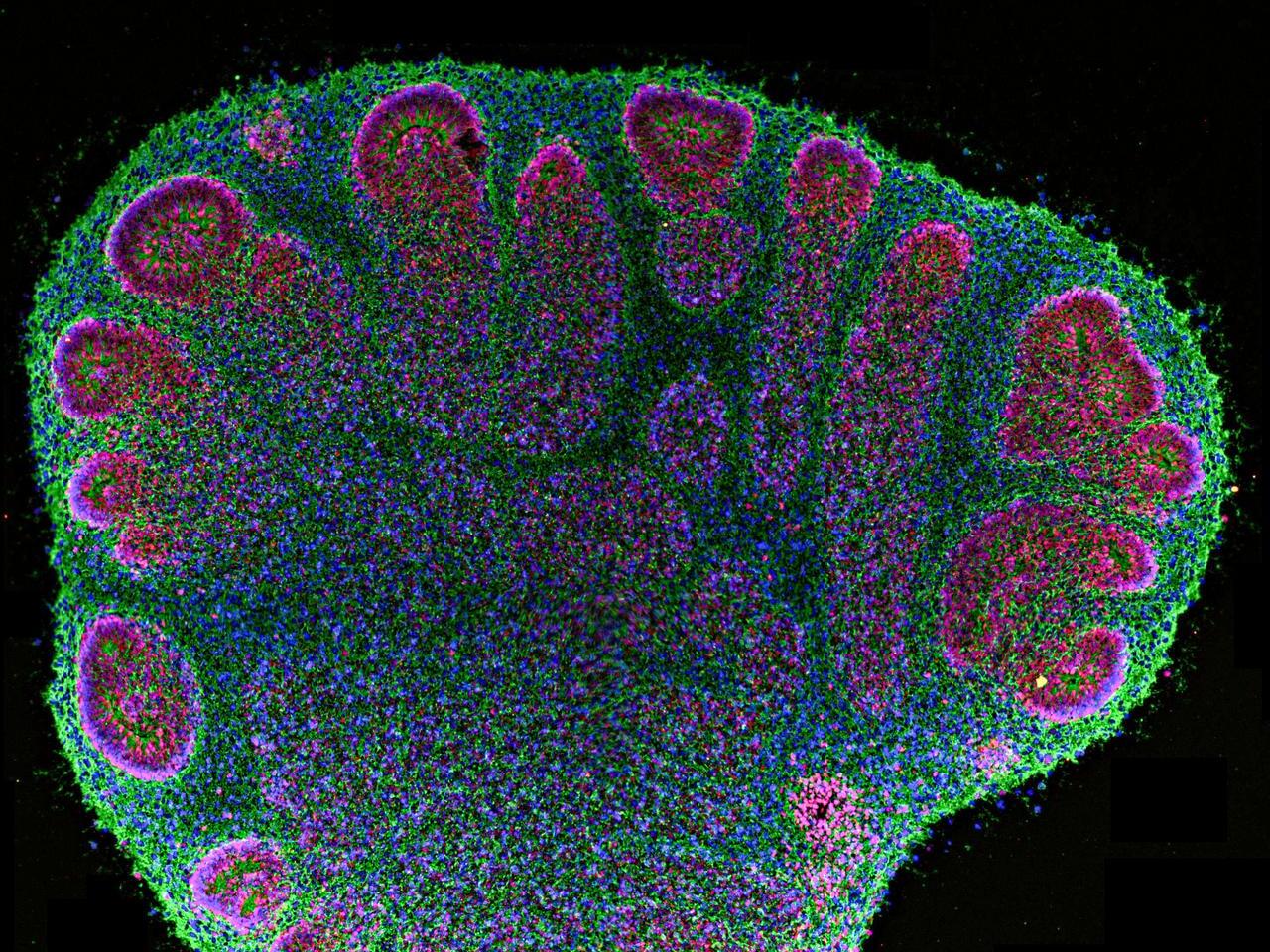 Brain Organoids Are Helping Researchers, but Their Use Also Creates Unease