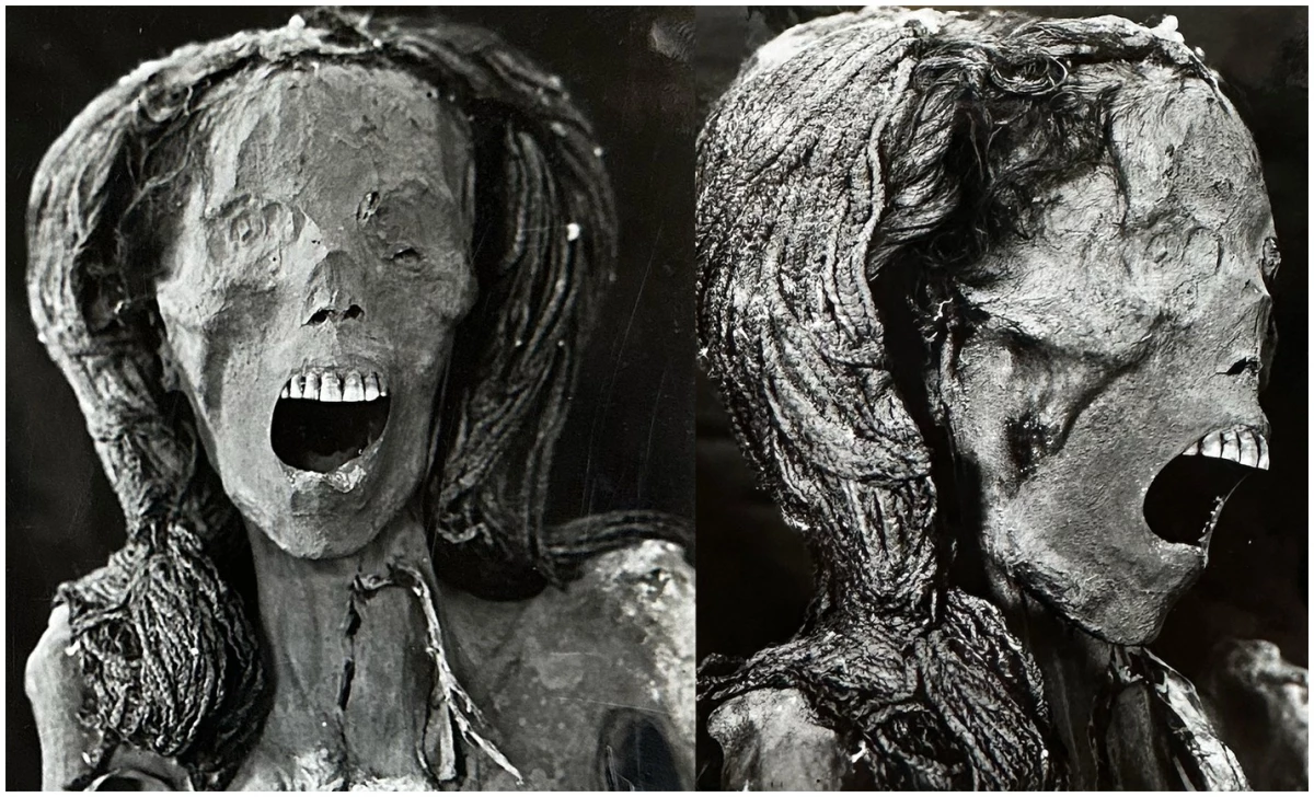 Photographs of the front and right profile of the head of the 'Screaming Woman' mummy were taken in 1939 at the Kasr Al Ainy Faculty of Medicine in Cairo.