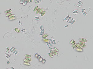 A microscopic slide shows the Desmodesmus algae that quickly turned the Reflecting Pool's water green. The new dark blue paint of the pool's lining makes the water warmer and friendlier to the algae growth.