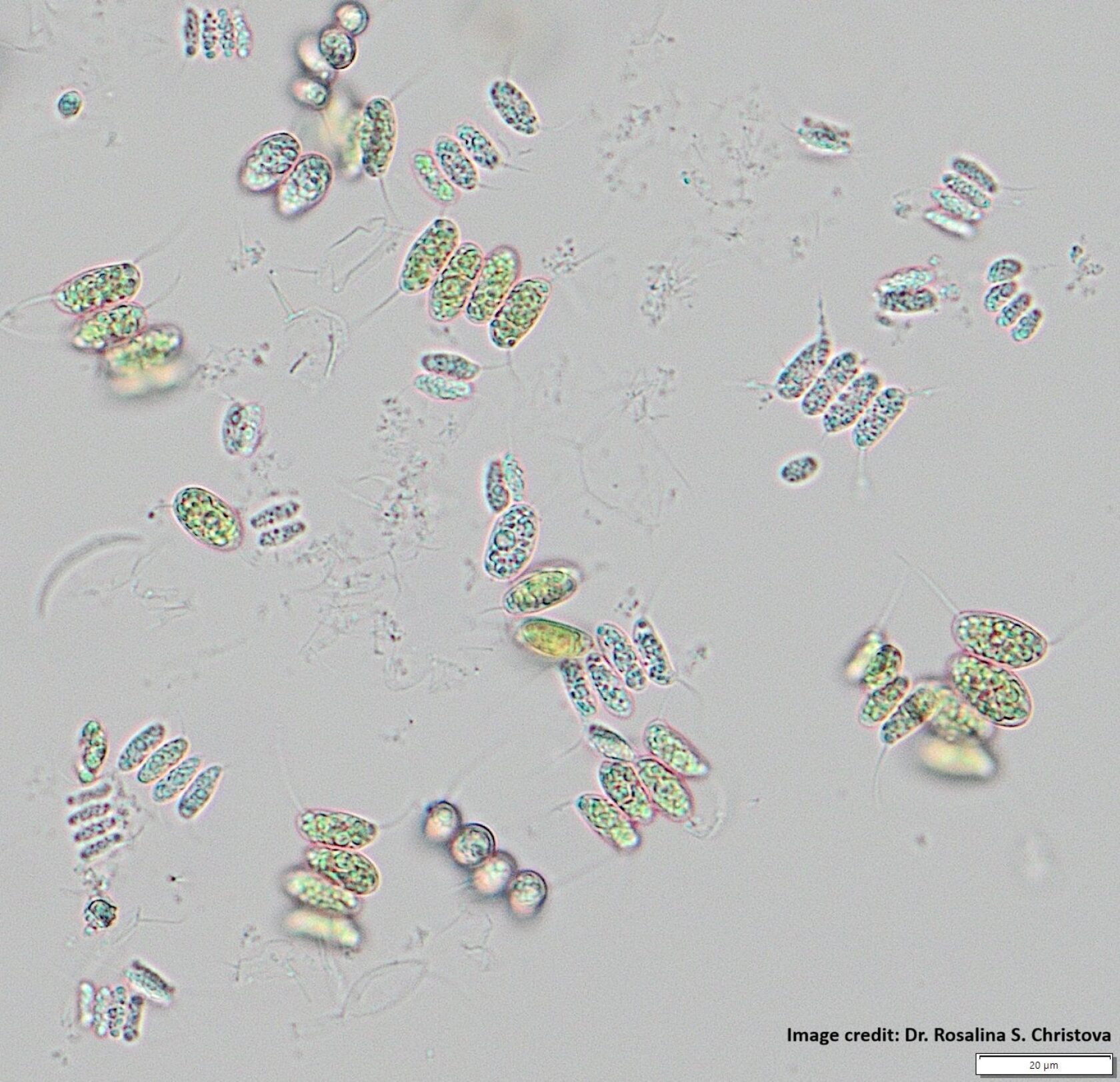 A microscopic slide shows the Desmodesmus algae that quickly turned the Reflecting Pool's water green. The new dark blue paint of the pool's lining makes the water warmer and friendlier to the algae growth.