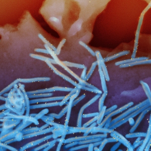 An electron microscope image provided by the National Institutes of Health shows human respiratory syncytial virus virions, colorized blue, and antibodies against an RSV protein, colorized yellow.