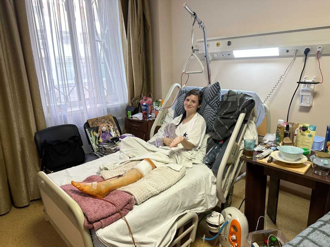 This Kyiv girl survived a 9-story fall from her residence throughout a Russian missile assault This Kyiv girl survived a 9-story fall from her residence throughout a Russian missile assault