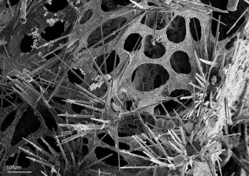 A microscopic image shows the structure of a newly discovered species now named Desmacella alaskensis. Scientists were able to identify the new species by studying the spicules, the tiny structural elements within sponges.