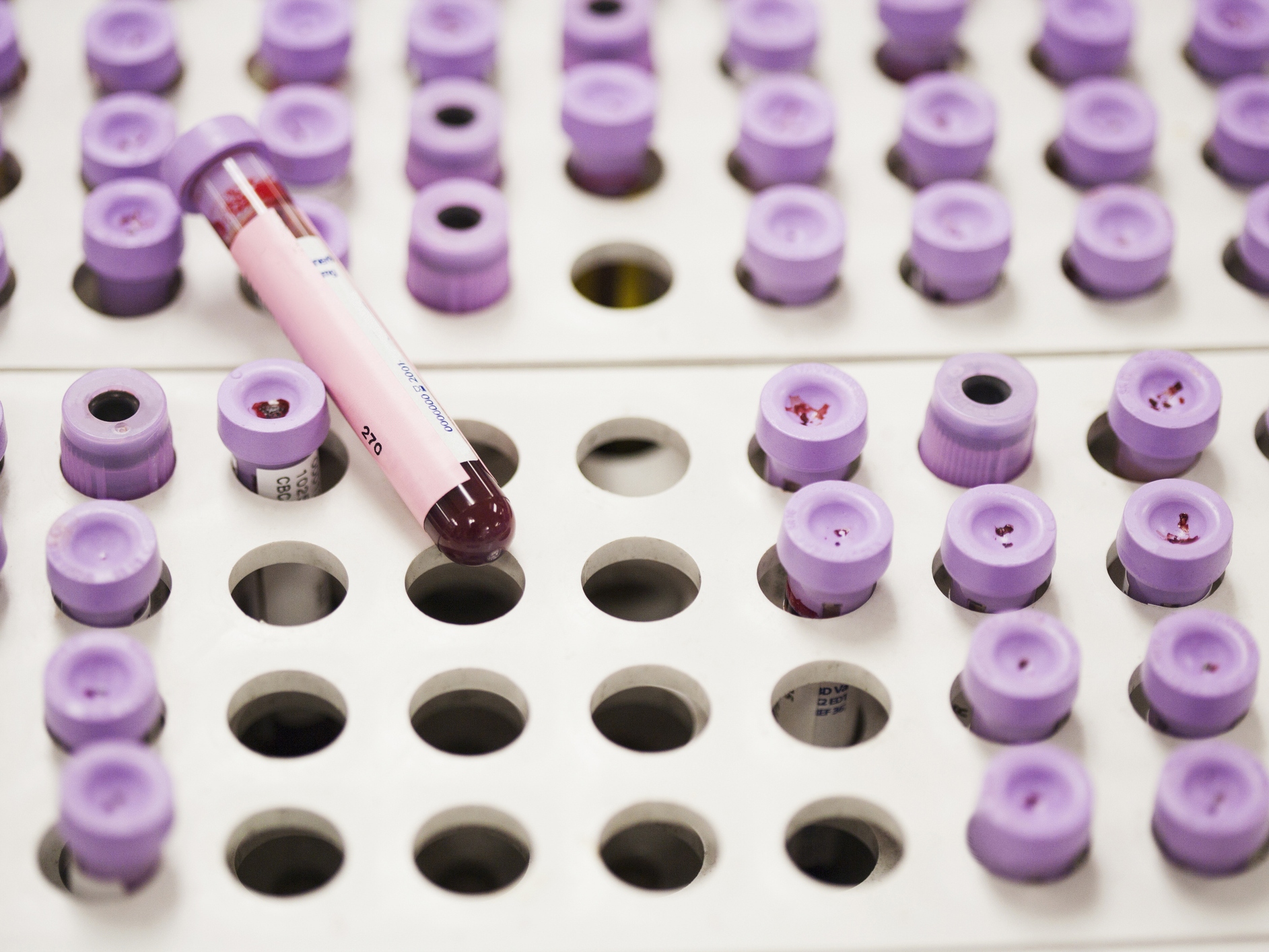 A Cholesterol Test You've Never Heard of Is Now Recommended to Prevent Heart Disease