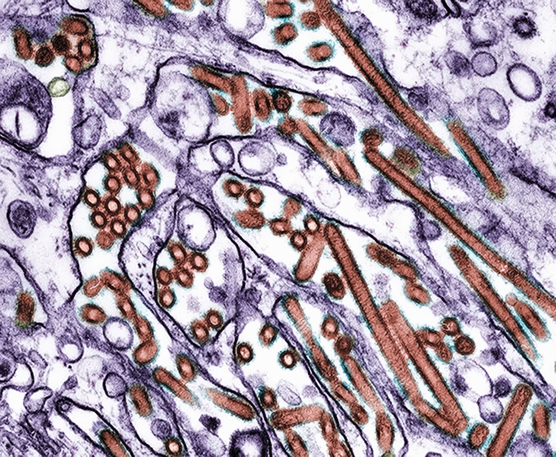 The H5N1 bird flu virus has infected more than 60 people in the U.S. during this current outbreak.