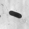 3rd person dies in listeria outbreak tied to Boar