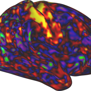 An image of the shows that as stimulants increase arousal, they calm (darker colors) various parts of the brain.