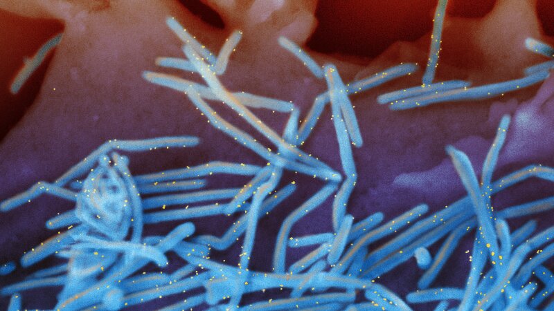 An electron microscope image provided by the National Institutes of Health shows human respiratory syncytial virus virions, colorized blue, and antibodies against an RSV protein, colorized yellow.
