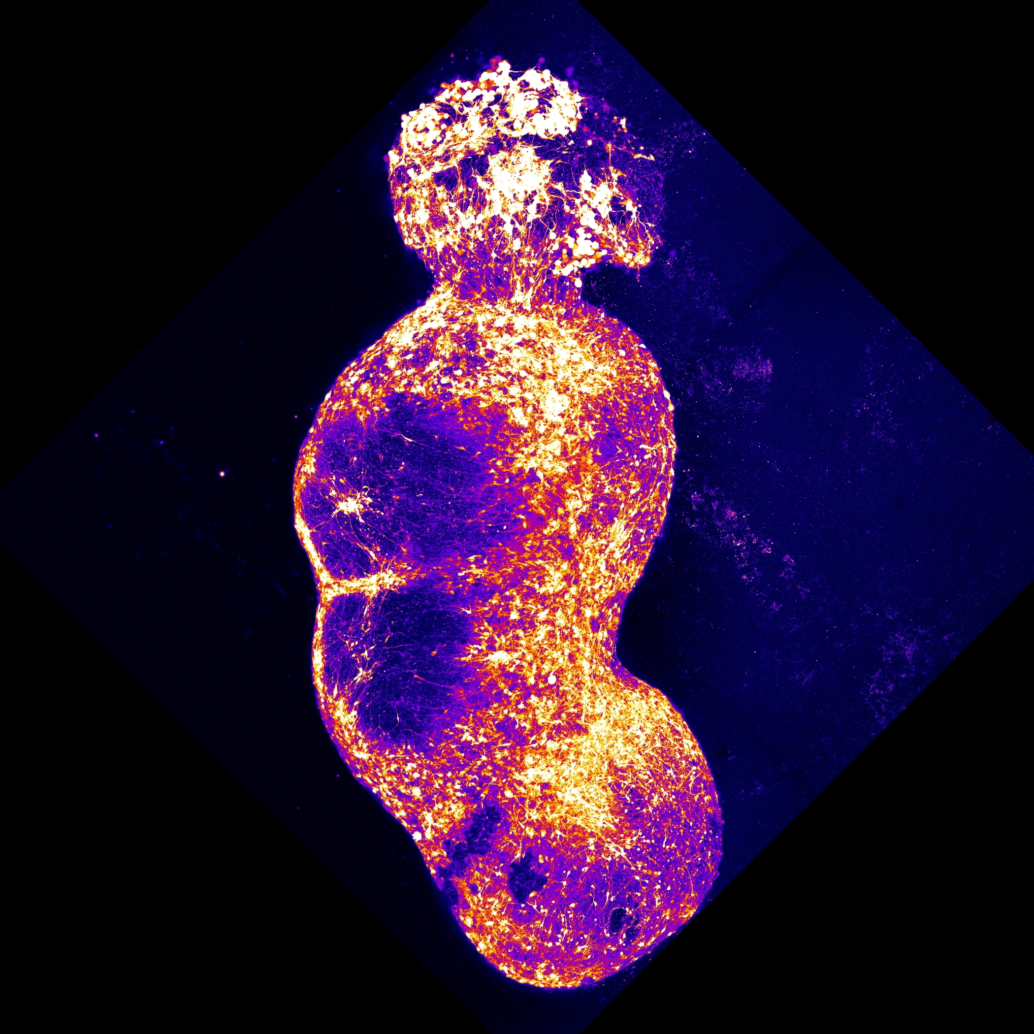 Researchers integrated four organoids that represent the four components of the human sensory pathway, along which pain signals are conveyed to the brain. Stimulation of the sensory organoid (top) by substances, such as capsaicin, triggers neuronal activity that is then transmitted throughout the rest of the organoids.