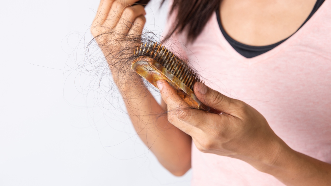 What to find out about remedies for feminine hair loss or alopecia : NPR What to find out about remedies for feminine hair loss or alopecia : NPR