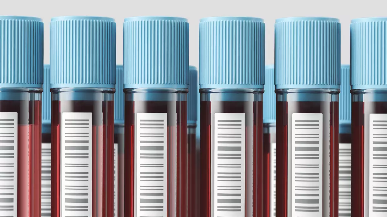 You can order your own blood work now. Interpreting the results is another story