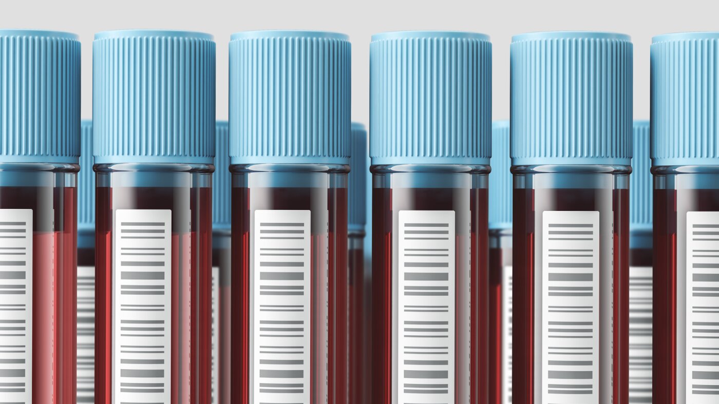 Artık kendi kan tahlilinizi sipariş edebilirsiniz. Sonuçların yorumlanması başka bir hikaye