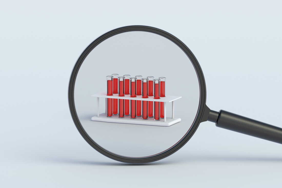 FDA advisory panel to vote on a multi-cancer blood check : NPR FDA advisory panel to vote on a multi-cancer blood check : NPR