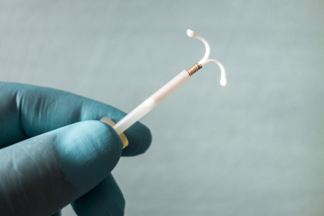 Iud Inversion Pain with IUD insertion? Lidocaine, laughing gas or valium can help ...