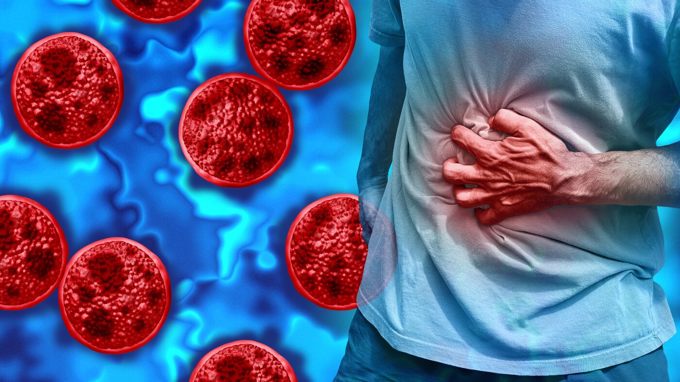 What Cyclospora does inside the gut and how it gets there