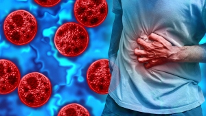 Cyclosporiasis is a parasitic illness caused by eating or drinking contaminated food or water.