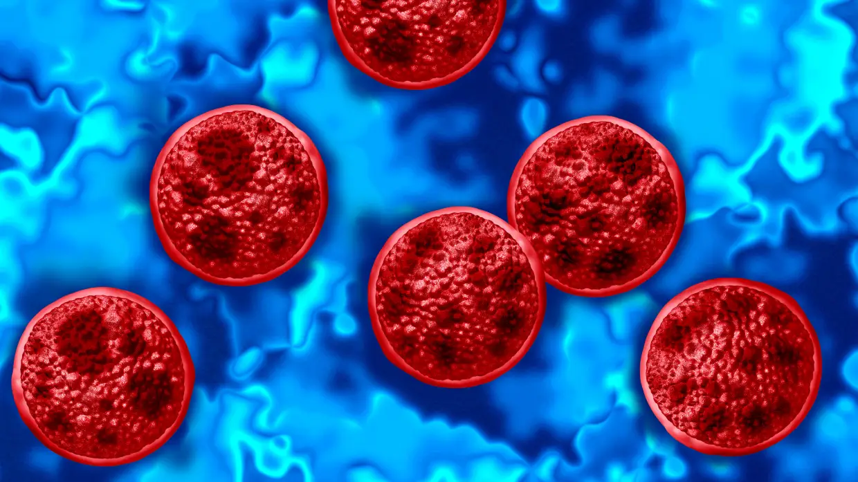 2 people in Michigan have died after becoming ill with cyclosporiasis