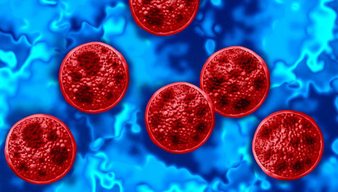 Two people in Michigan have died after becoming ill with cyclosporiasis Two people in Michigan have died after becoming ill with cyclosporiasis