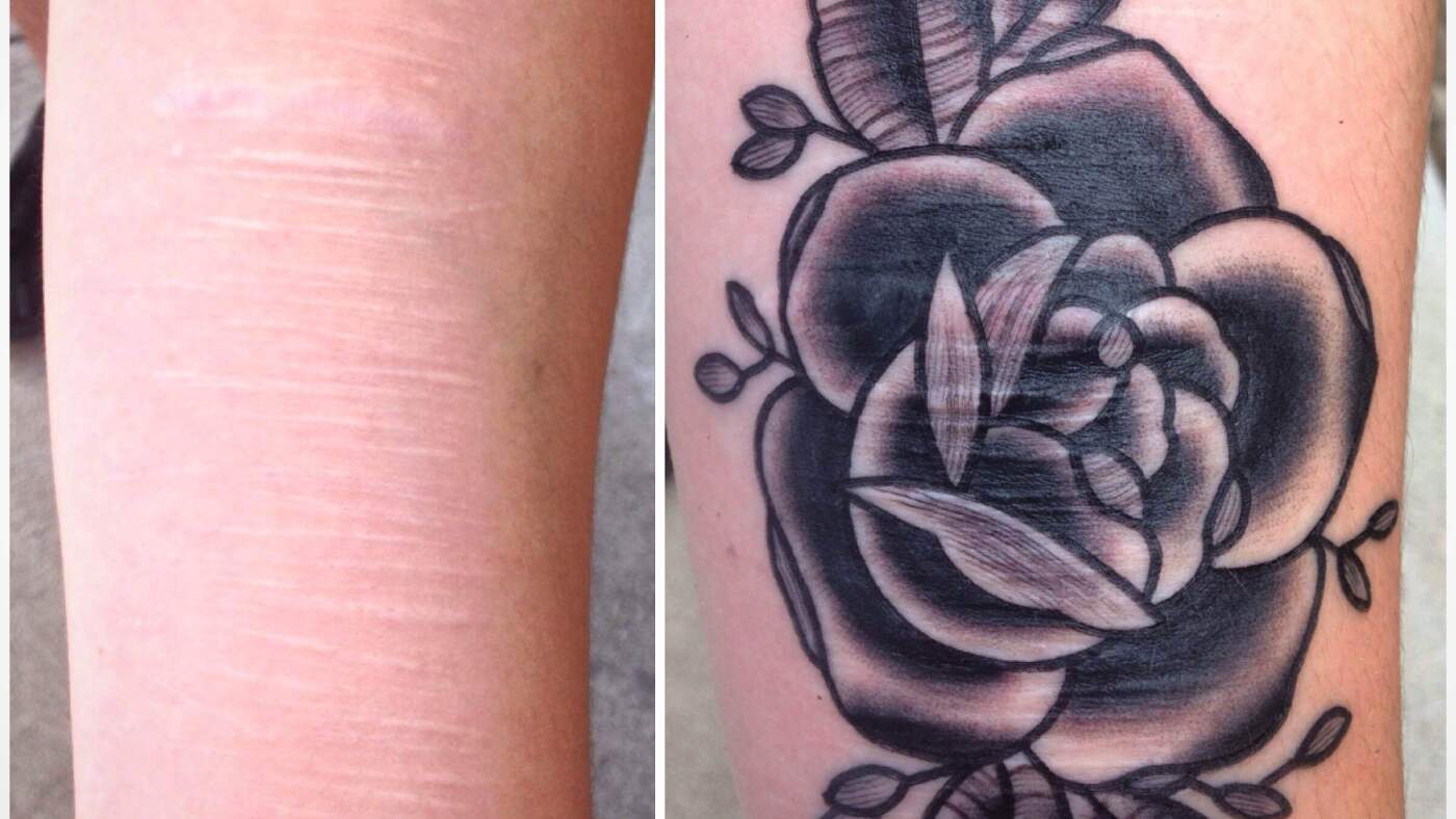 How a Toledo tattoo artist helps turn scars into art