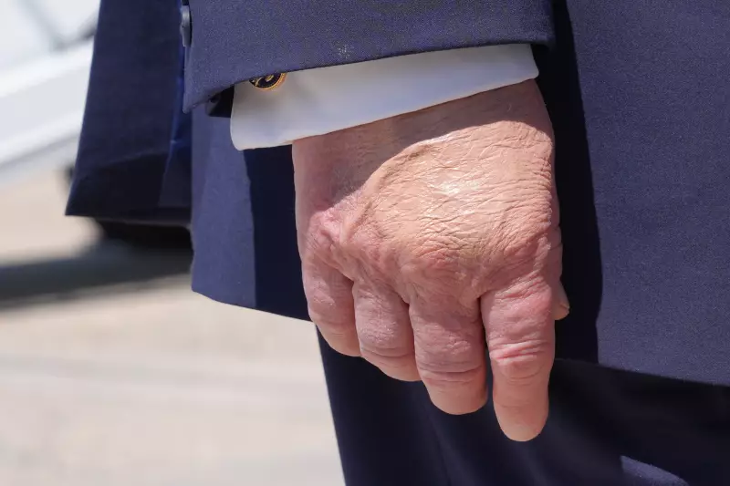 President Donald Trump's right hand is seen as he speaks to the press after returning and stepping off Air Force One, Wednesday, May 20, 2026, at Joint Base Andrews, Md., after speaking at the U.S. Coast Guard Academy commencement.