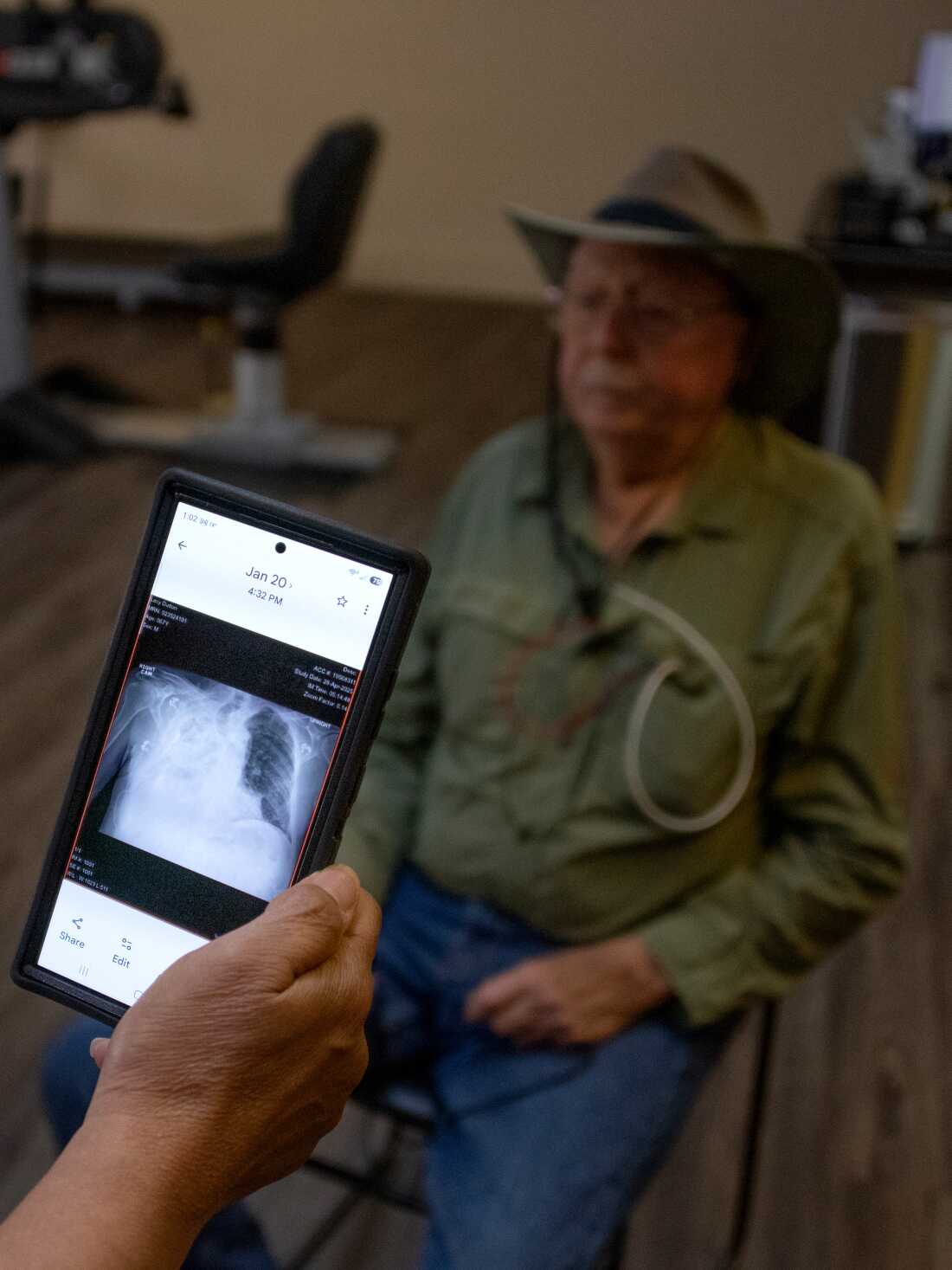 Radiologist Brandon Crum holds a tablet that shows an image of a coal miner's lungs, which are riddled with fibrotic tissue.