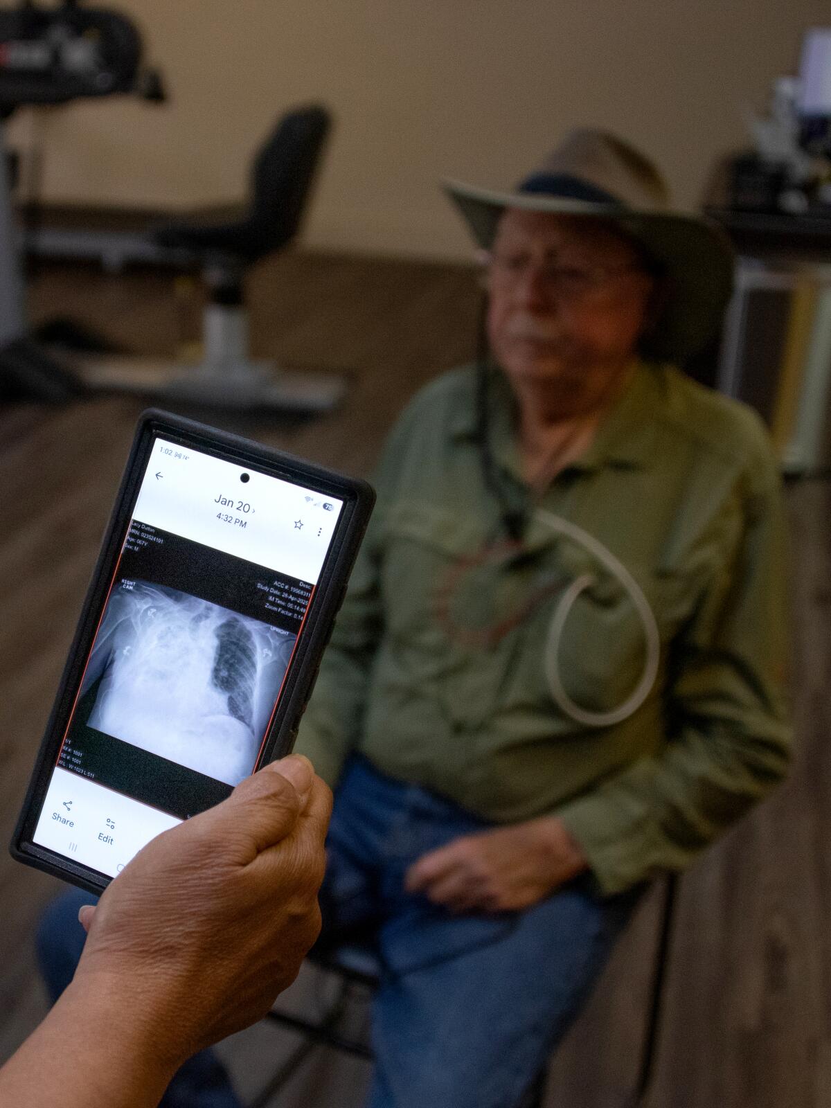 Radiologist Brandon Crum scrutinizes an image of a coal miner's lungs in his clinic in Coal Run Village, Ky. The lungs were riddled with fibrotic tissue, the breath-stealing signature of black lung disease.