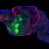 This side view of a lab mouse brain shows nerve fibers extending from the human graft (colored with green and red fluorescent proteins) through the mouse brain (colored with blue). Scale bar = 1 mm.