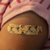A bandage is seen on a child's arm after she received a COVID vaccine on November 3, 2021 in Shoreline, Washington.