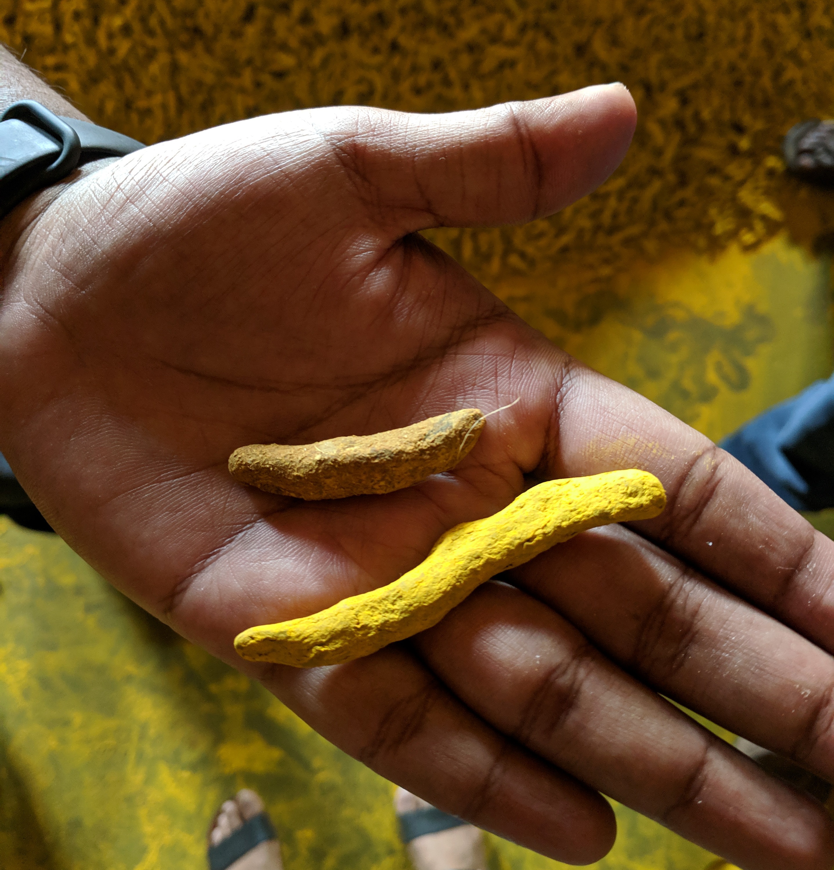 In Bangladesh, turmeric — sold as the root or in a powder form — is a popular spice. In the 1980s, some farmers began adding a dye to make the root more attractive to buyers. But there was a problem with the dye.