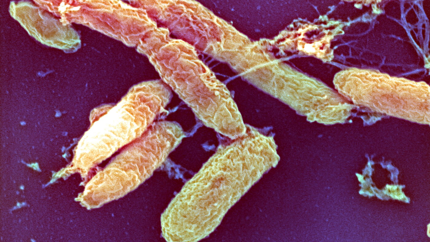 What is the pneumonic plague?