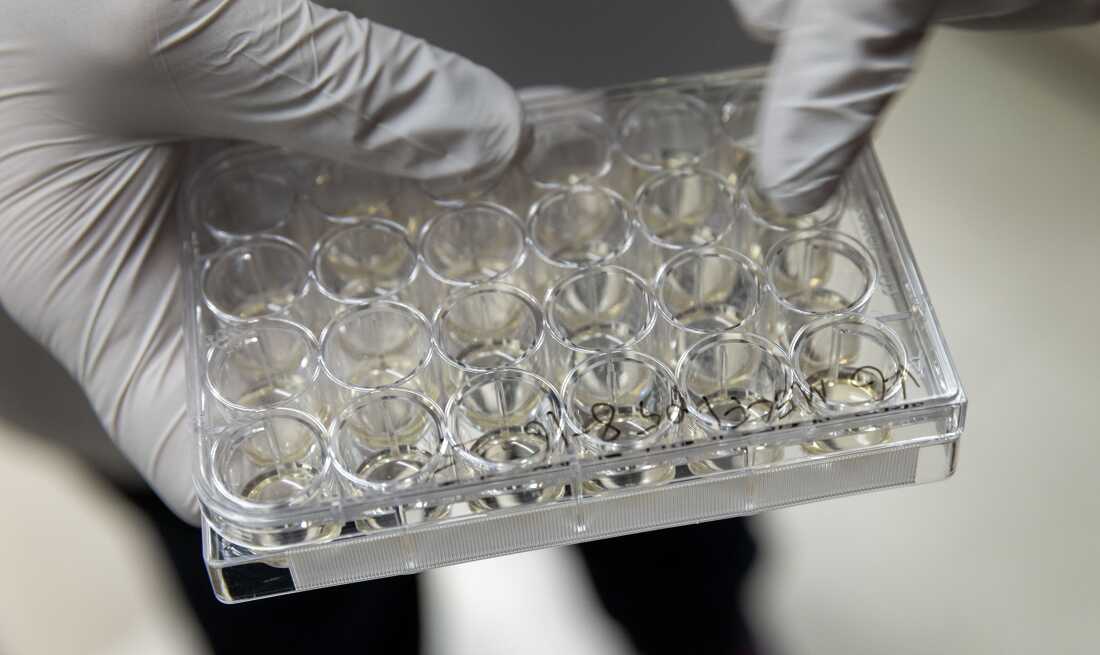 Dieses Foto zeigt ein durchsichtiges Labortesttablett aus Kunststoff, das mit Reihen kreisförmiger Vertiefungen gefüllt ist. Eine Hand mit weißem Handschuh hält das Tablett.
