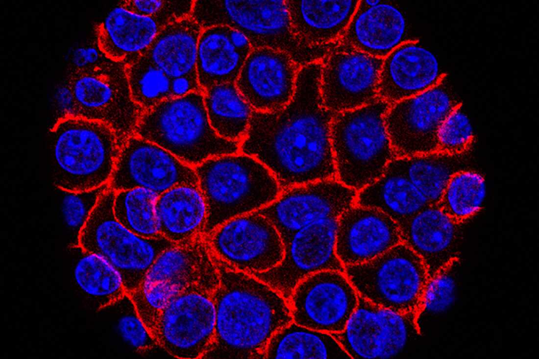 This undated microscope image from USC via the NIH shows pancreatic cancer cells, nuclei in blue, growing as a sphere encased in membranes, red.