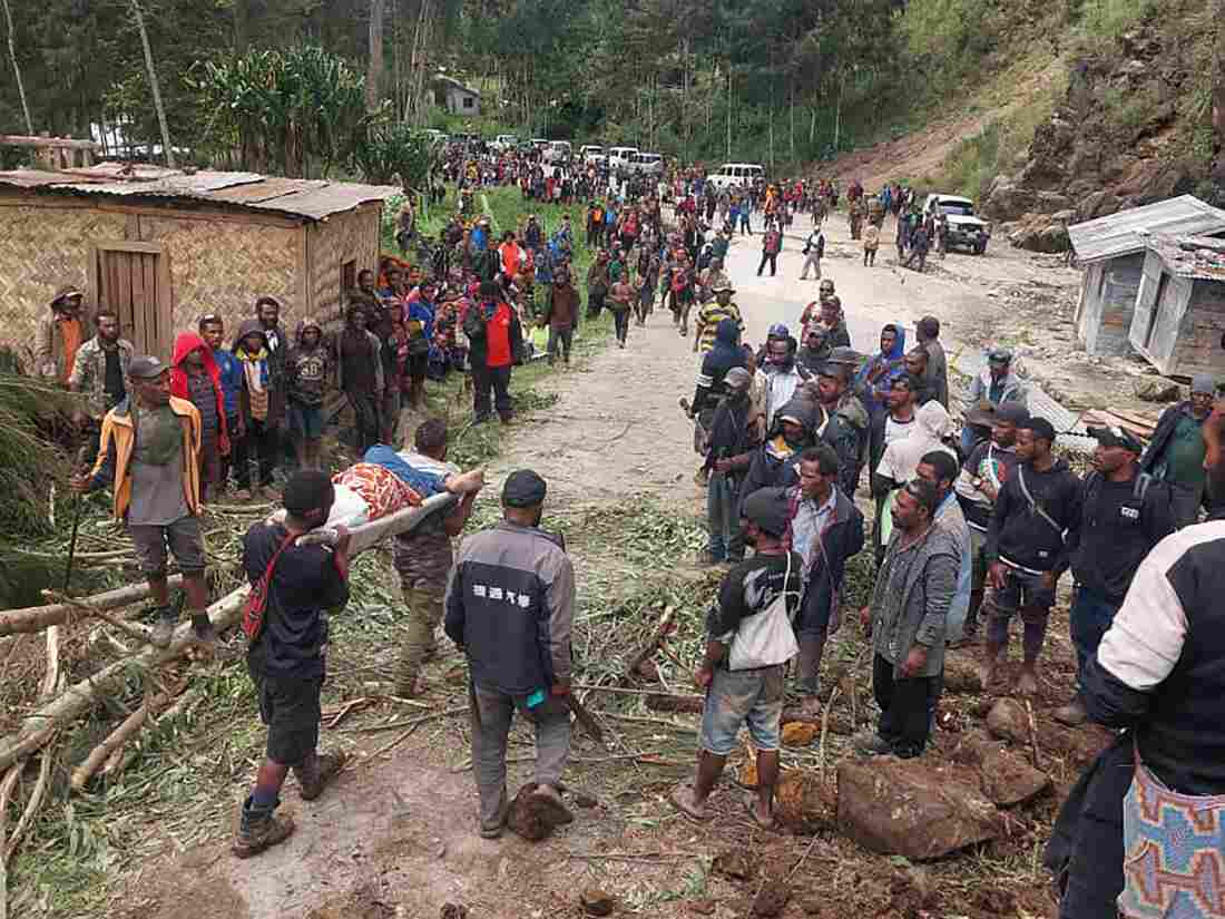 In this photo provided by the International Organization for Migration, an injured person is carried on a stretcher to seek medical assistance after a landslide in Yambali village, Papua New Guinea, Friday, May 24, 2024. More than 100 people are believed to have been killed in the landslide that buried a village and an emergency response is underway, officials said.