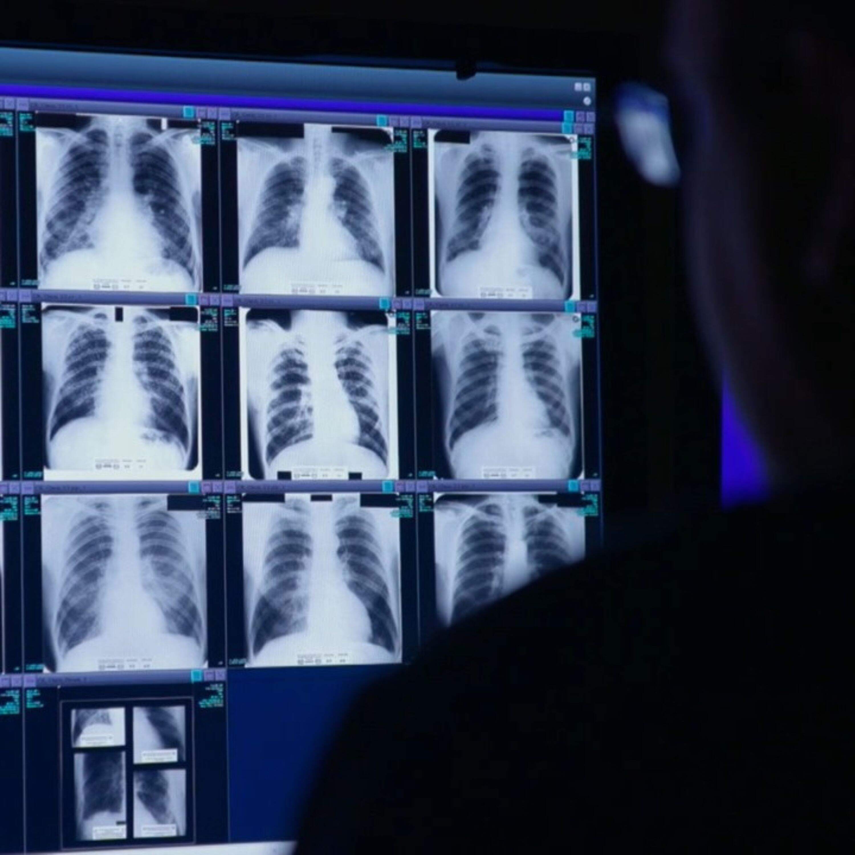 The black lung crisis deepens in Appalachia Episode cover