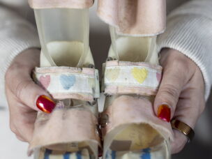 Marlatt holds the first leg braces she wore as a child.