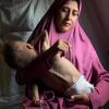 Mohammad is a year and a half old and nearly all bone. His eyes protrude, as does his swollen stomach. His spine is so sharp and so defined, it seems it might poke through his thin skin.