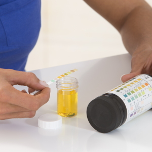A person using a urine analysis test. A recent study found that many women treated for recurrent UTIs didn't have UTIs at all. Instead, their symptoms were caused by hormonally driven inflammation and pelvic floor dysfunction.