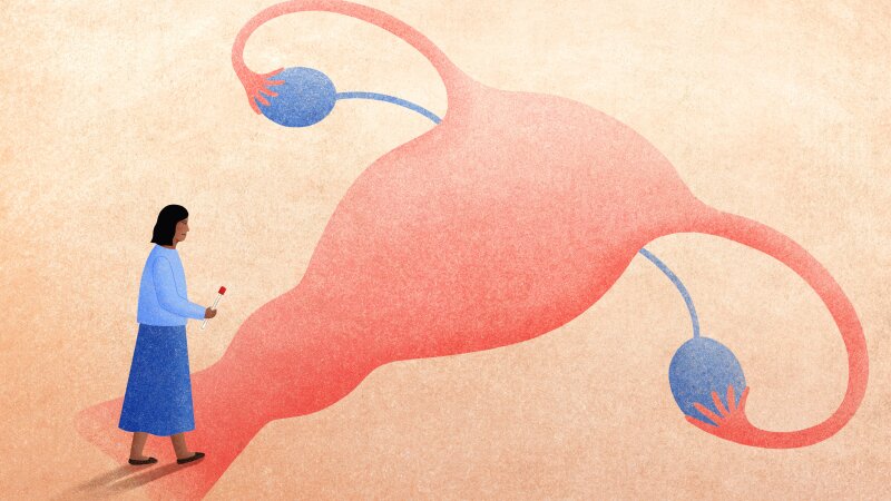 A woman considers her options for cervical cancer screening